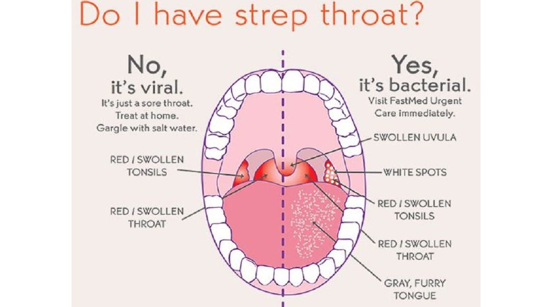 sore-throat-anatomy