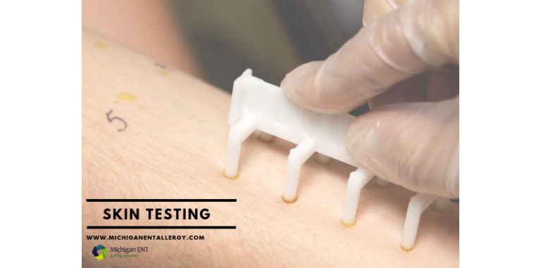 Patient receiving skin testing